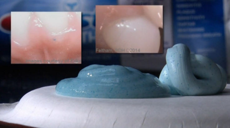 Plastic beads found in your toothpaste!!!